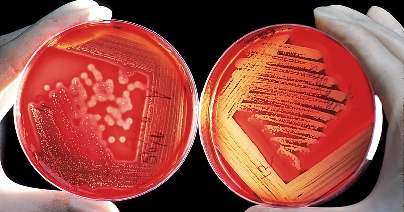 Gélatine ou agar-agar : laquelle choisir ?